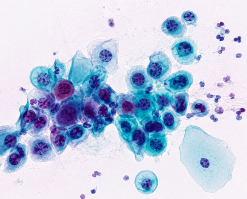 Citologia urinaria